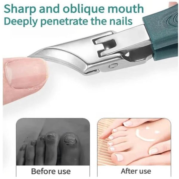 ✂️✨ Eagle Beak Wide Jaw Nail Clippers Set | Anti-Splash 25° Slanted Blade for Thick & Ingrown Toenails | Ultra-Sharp Stainless Steel Manicure & Pedicure Tool